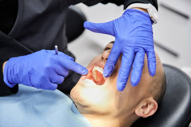 Best Emergency Dentist for Lost Fillings or Crowns in Meron Park, CA