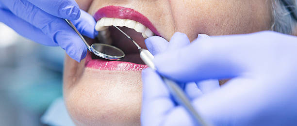 Best Emergency Dentist for Special Needs Patients in Meron Park, CA